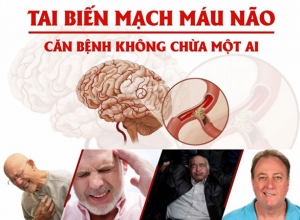 Mối nguy hiểm từ bệnh tai biến và cách phòng chống